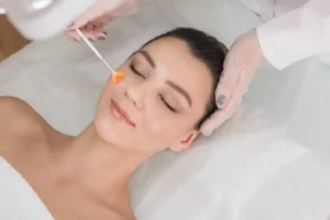 Chemical Peels by A Better Solution in Florida